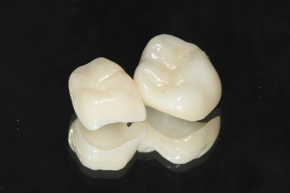 要望に合わせた素材をご提案