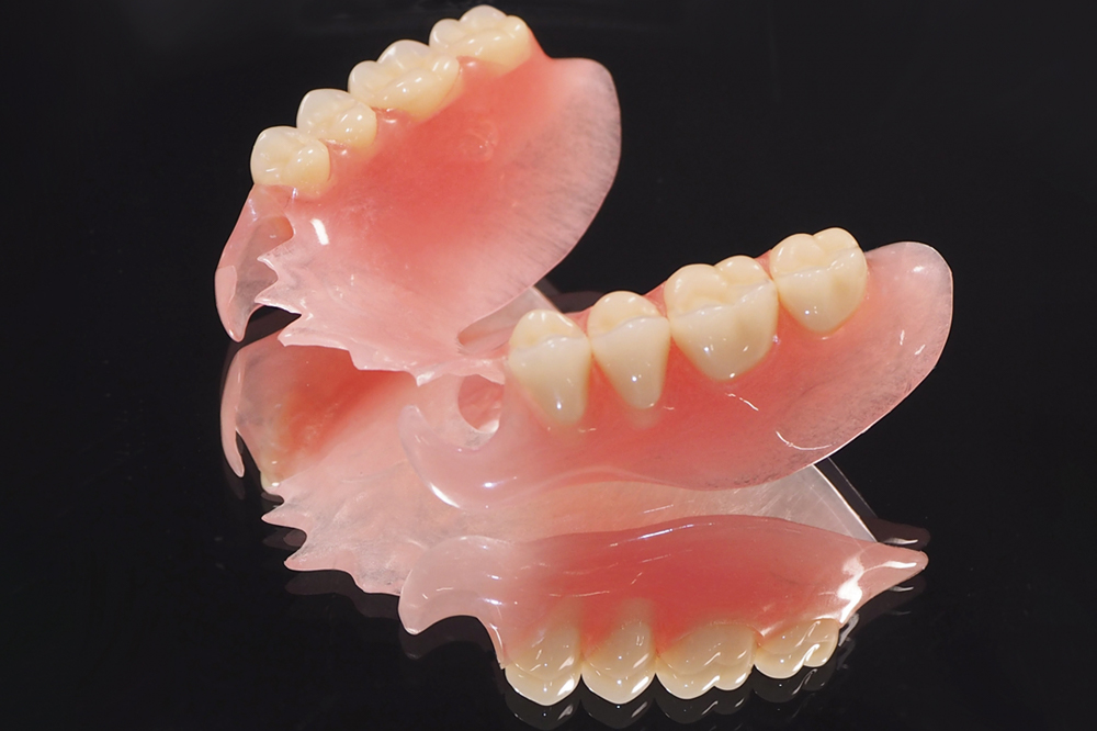 金属不使用の目立たない入れ歯