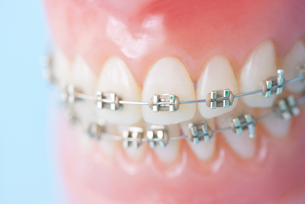 治療期間について